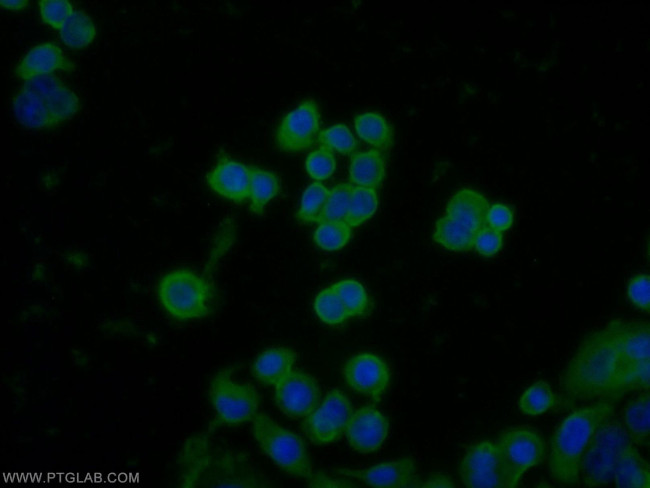 CPN1 Antibody in Immunocytochemistry (ICC/IF)