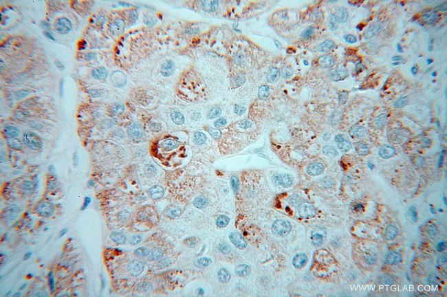 CPN1 Antibody in Immunohistochemistry (Paraffin) (IHC (P))