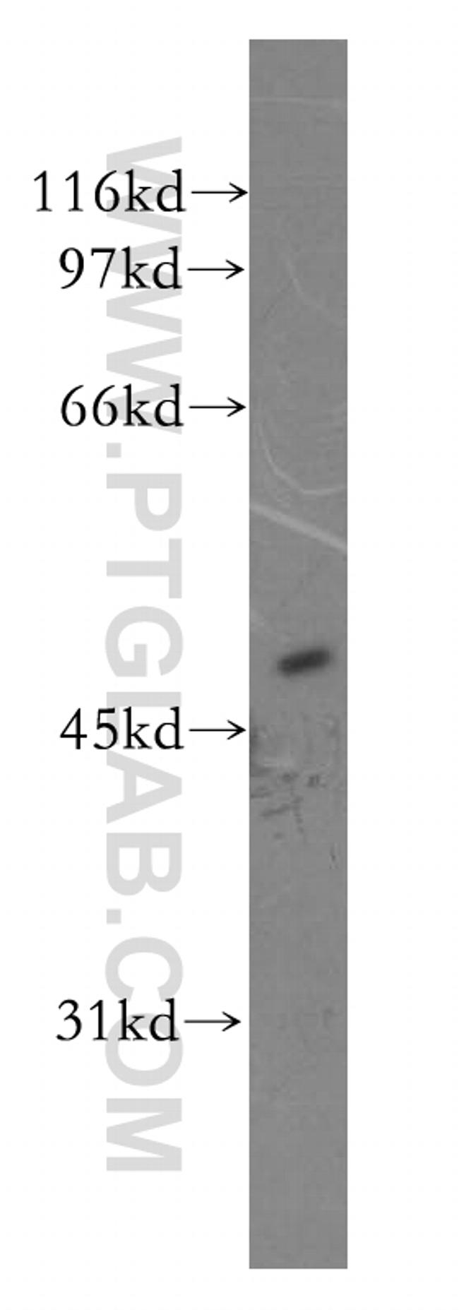 CPN1 Antibody in Western Blot (WB)