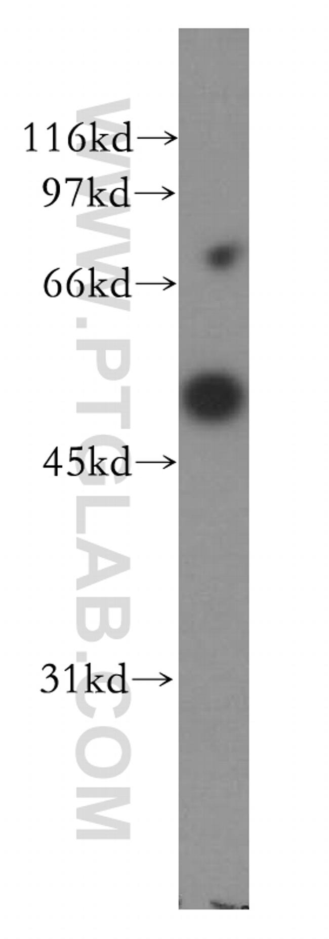 CPN1 Antibody in Western Blot (WB)