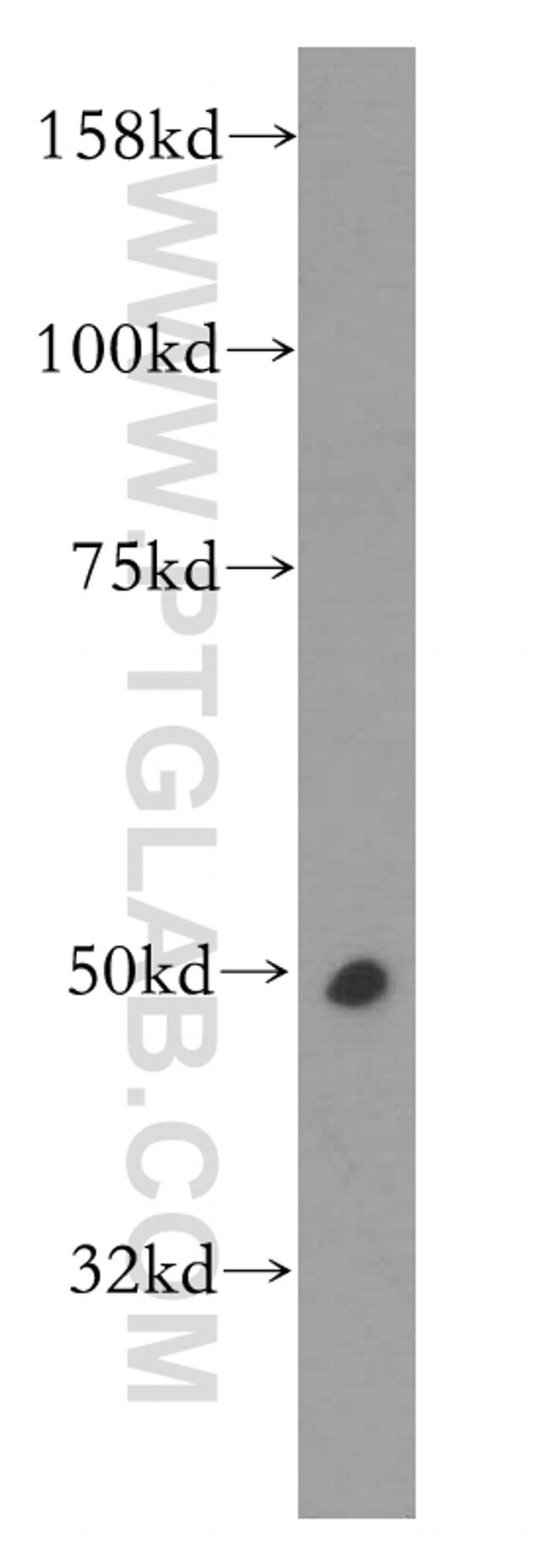 CPN1 Antibody in Western Blot (WB)