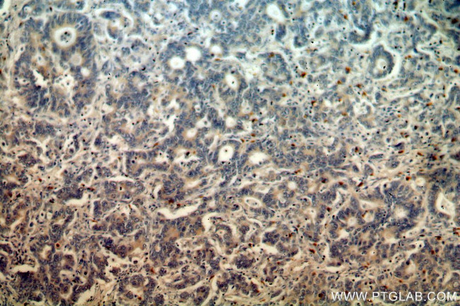 IHH Antibody in Immunohistochemistry (Paraffin) (IHC (P))