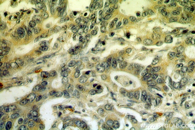 IHH Antibody in Immunohistochemistry (Paraffin) (IHC (P))