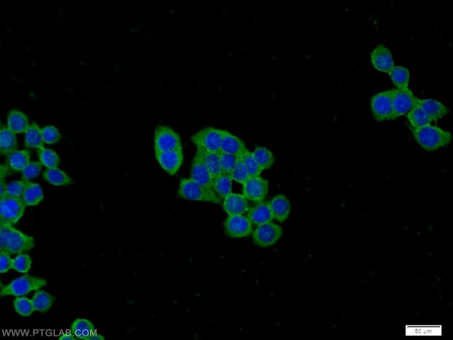 PFKP Antibody in Immunocytochemistry (ICC/IF)