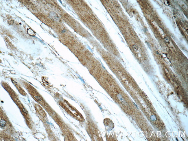 PFKP Antibody in Immunohistochemistry (Paraffin) (IHC (P))