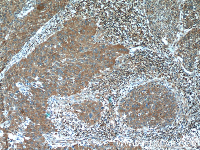 PFKP Antibody in Immunohistochemistry (Paraffin) (IHC (P))