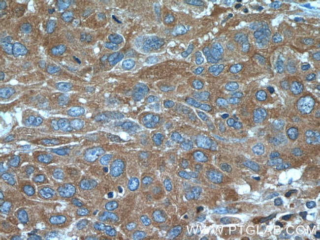 PFKP Antibody in Immunohistochemistry (Paraffin) (IHC (P))