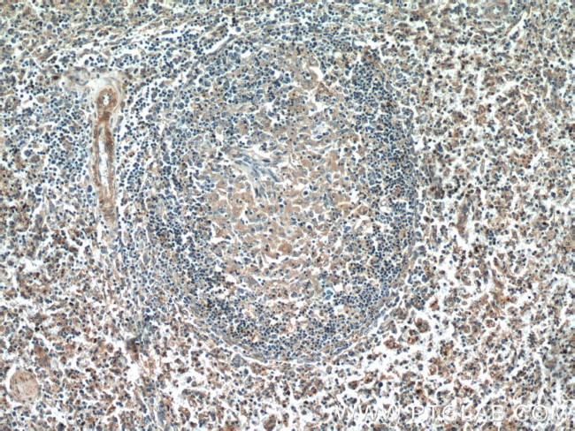 PFKP Antibody in Immunohistochemistry (Paraffin) (IHC (P))