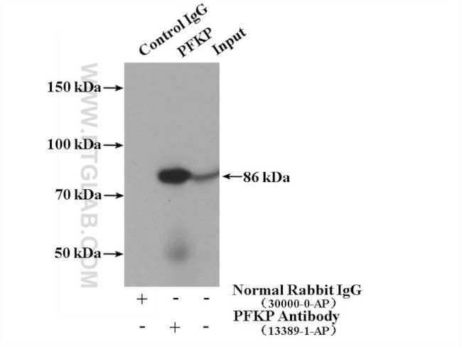 PFKP Antibody in Immunoprecipitation (IP)