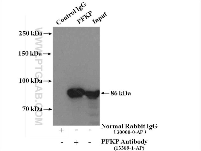 PFKP Antibody in Immunoprecipitation (IP)