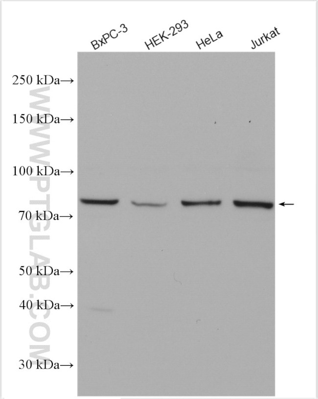 PFKP Antibody in Western Blot (WB)