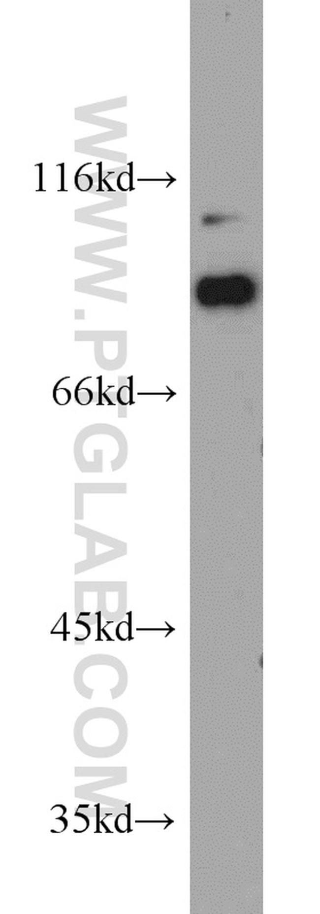 PFKP Antibody in Western Blot (WB)