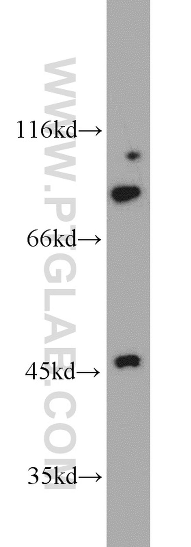 PFKP Antibody in Western Blot (WB)