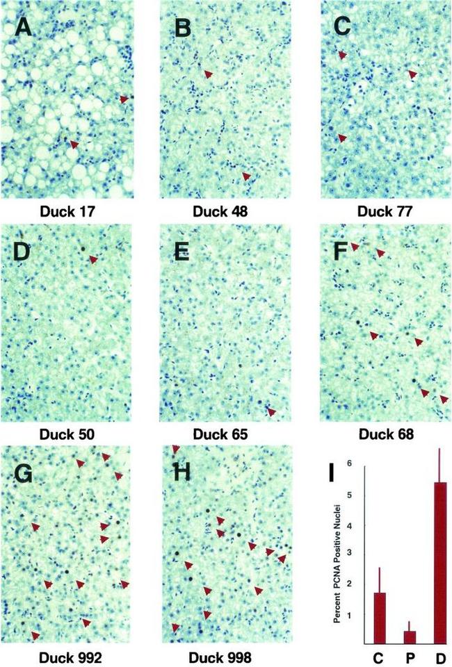 PCNA Antibody in Immunohistochemistry (IHC)