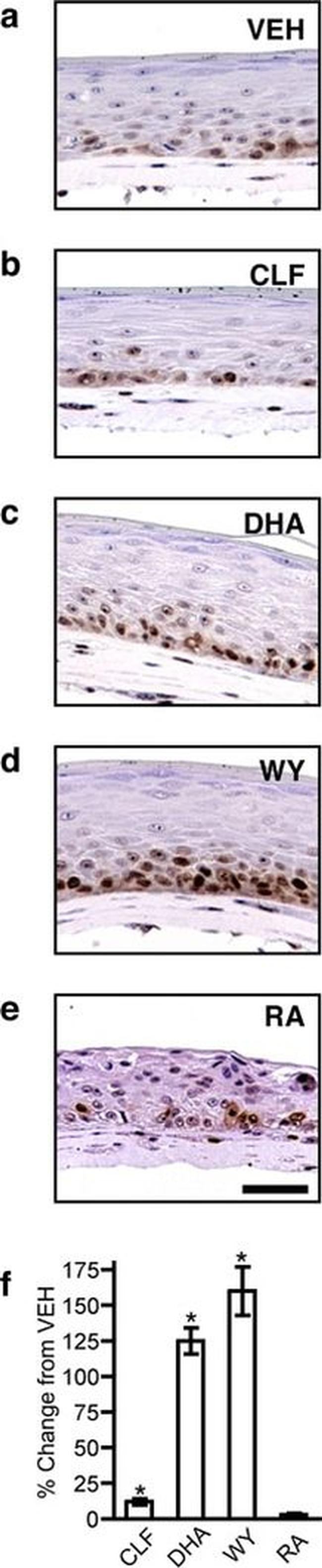 PCNA Antibody in Immunohistochemistry (IHC)