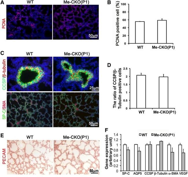 PCNA Antibody in Immunohistochemistry (IHC)