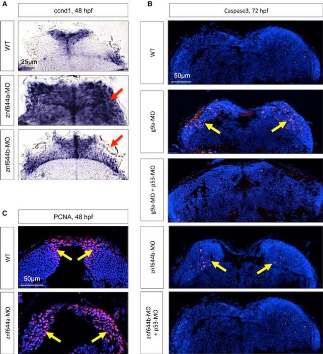 PCNA Antibody in Immunohistochemistry (IHC)