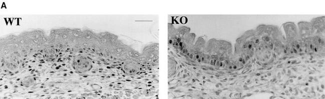 PCNA Antibody in Immunohistochemistry (IHC)