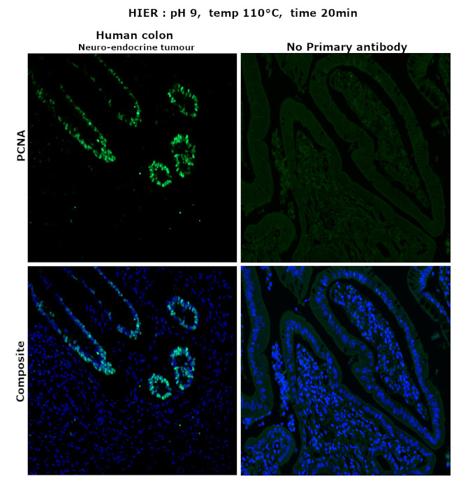 PCNA Antibody in Immunohistochemistry (Paraffin) (IHC (P))