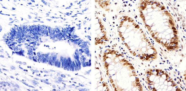 PCNA Antibody in Immunohistochemistry (Paraffin) (IHC (P))