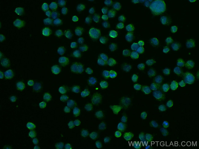 Galectin-4 Antibody in Immunocytochemistry (ICC/IF)