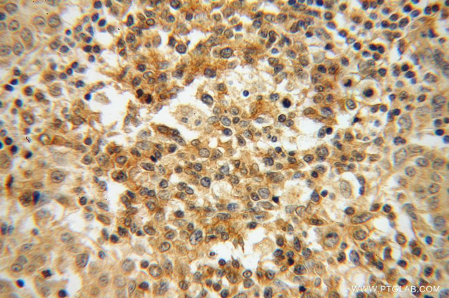 Galectin-4 Antibody in Immunohistochemistry (Paraffin) (IHC (P))