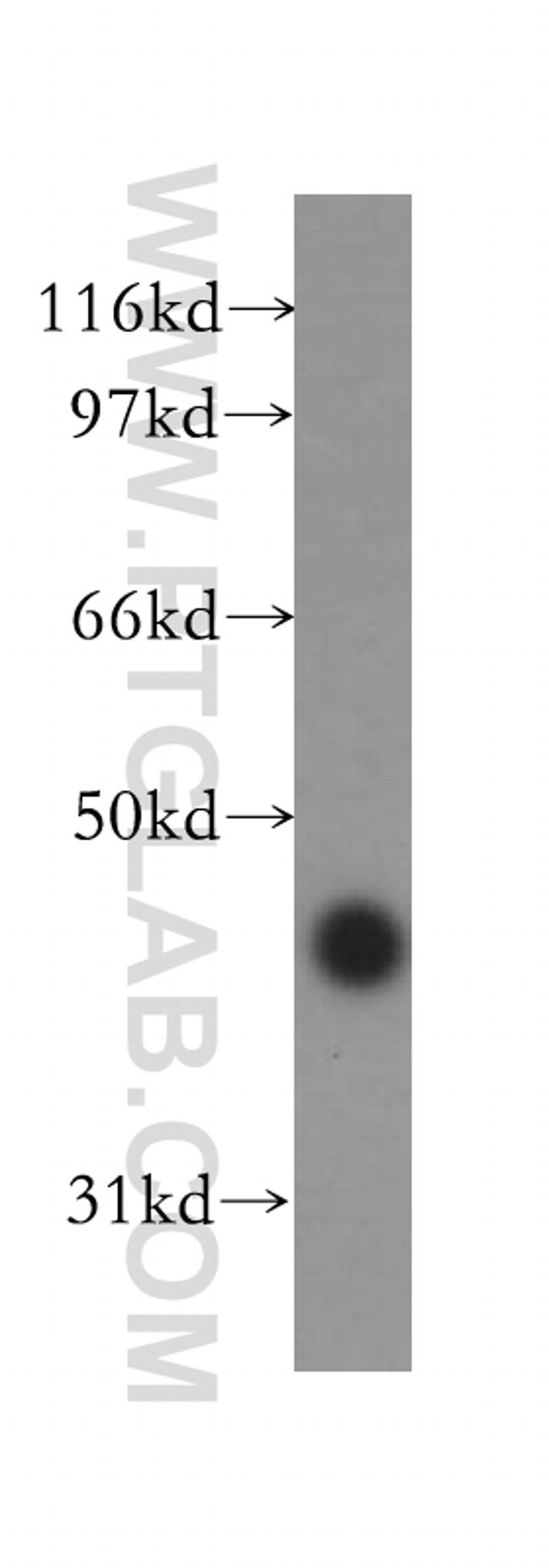 Galectin-4 Antibody in Western Blot (WB)