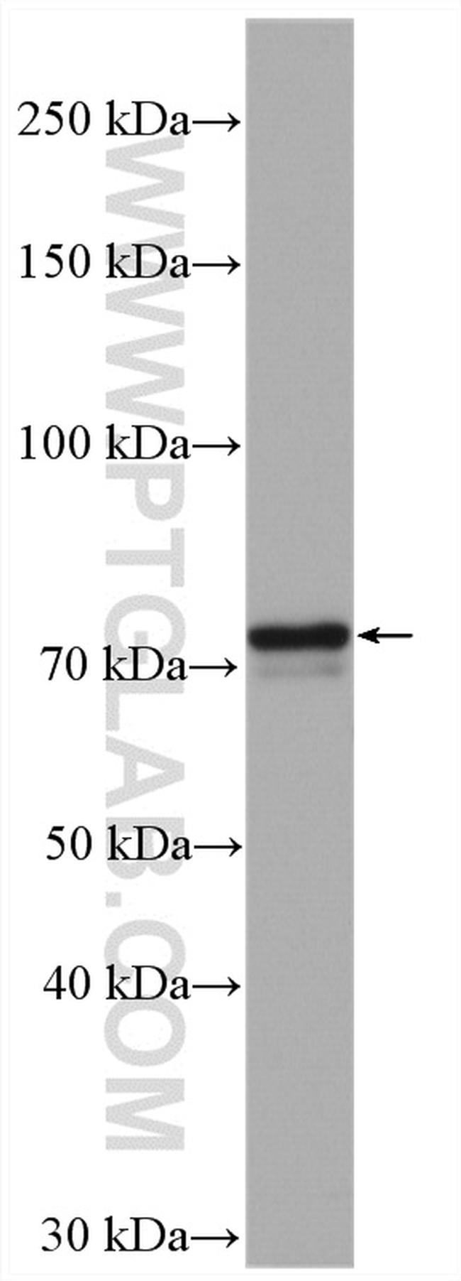 COX-1/Cyclooxygenase-1 Antibody in Western Blot (WB)