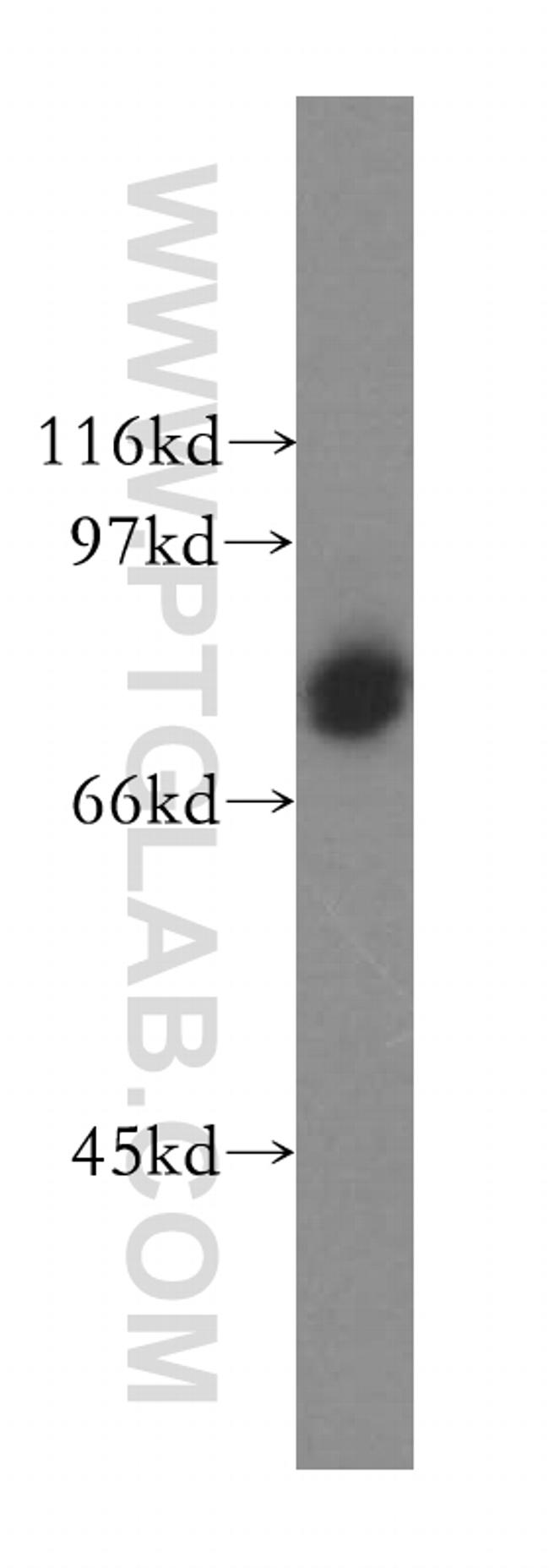 CD86 Antibody in Western Blot (WB)