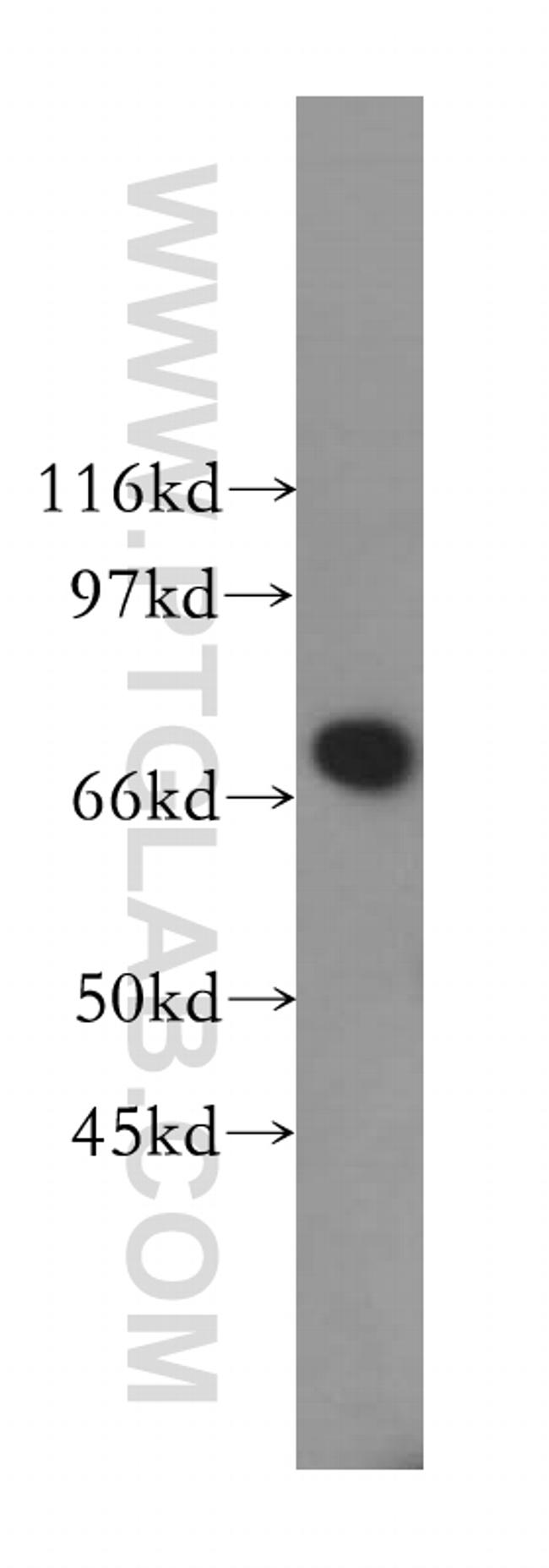 B4GALNT1 Antibody in Western Blot (WB)