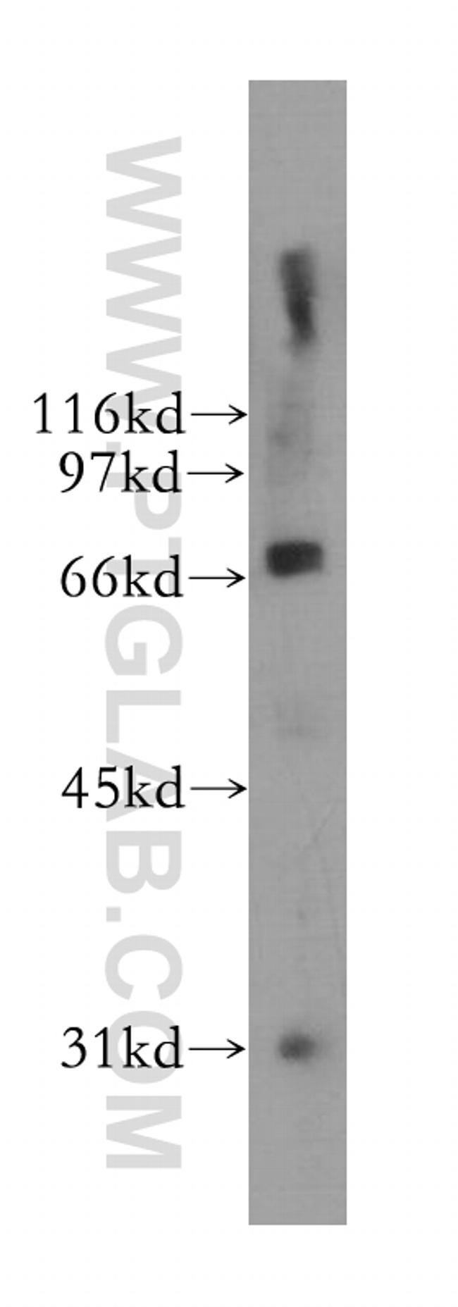 B4GALNT1 Antibody in Western Blot (WB)