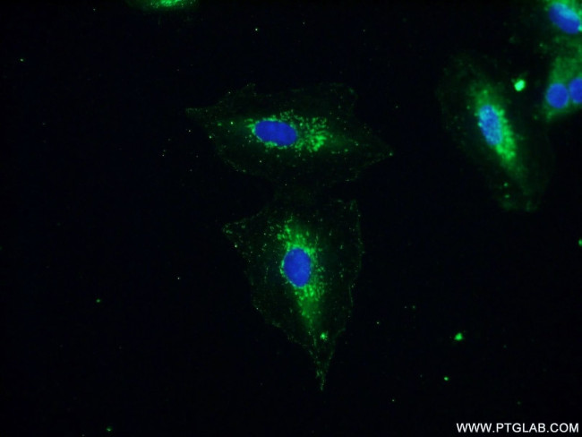 MIP-3-beta Antibody in Immunocytochemistry (ICC/IF)