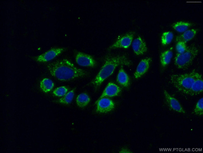 MIP-3-beta Antibody in Immunocytochemistry (ICC/IF)