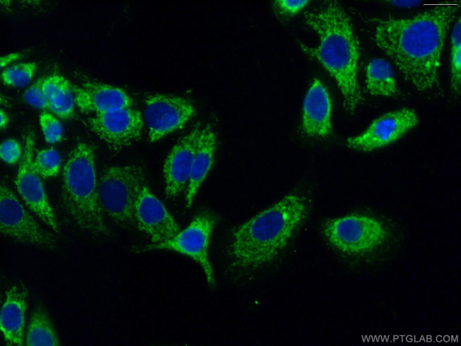 MIP-3-beta Antibody in Immunocytochemistry (ICC/IF)