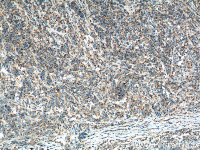 MIP-3-beta Antibody in Immunohistochemistry (Paraffin) (IHC (P))