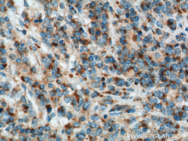 MIP-3-beta Antibody in Immunohistochemistry (Paraffin) (IHC (P))