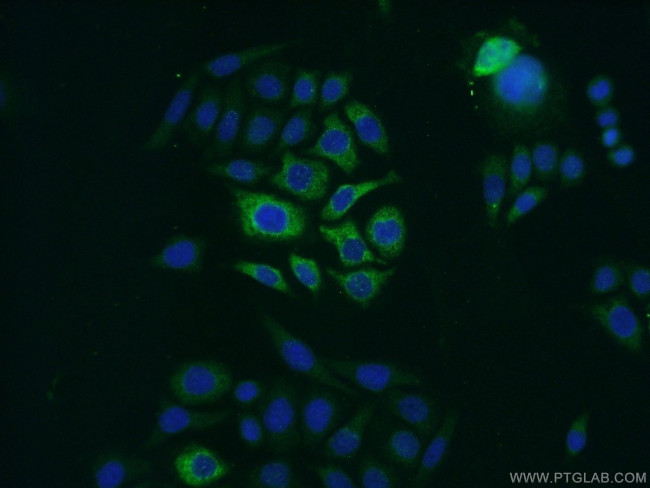 Zinc-alpha-2-glycoprotein Antibody in Immunocytochemistry (ICC/IF)