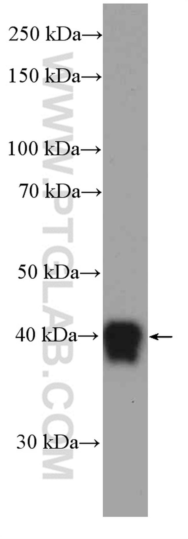 Zinc-alpha-2-glycoprotein Antibody in Western Blot (WB)