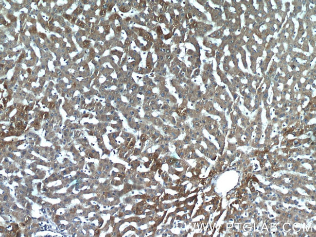 PHKB Antibody in Immunohistochemistry (Paraffin) (IHC (P))