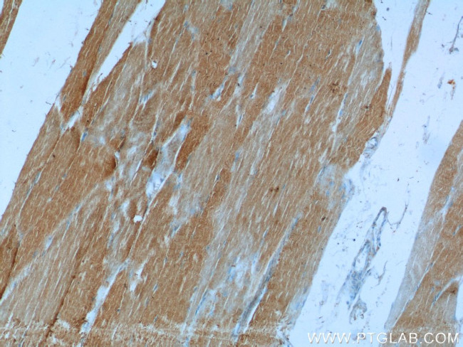 PHKB Antibody in Immunohistochemistry (Paraffin) (IHC (P))