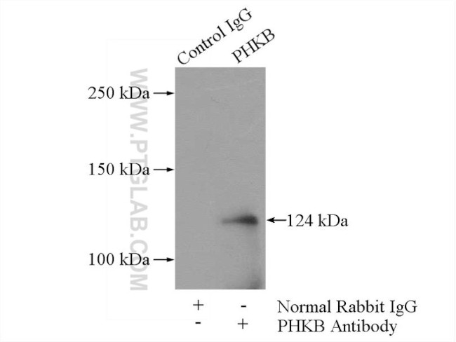 PHKB Antibody in Immunoprecipitation (IP)