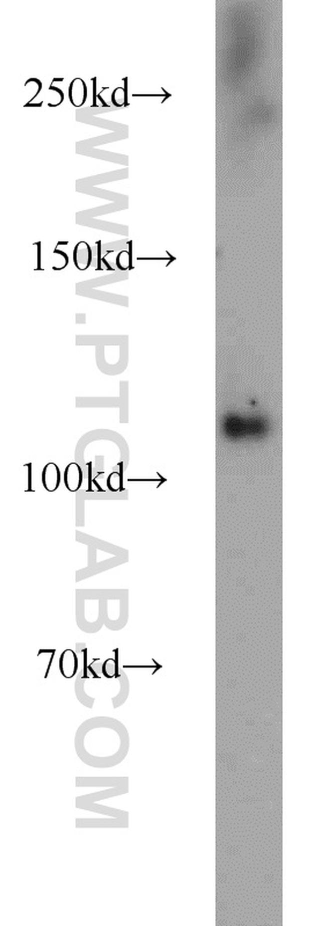 PHKB Antibody in Western Blot (WB)