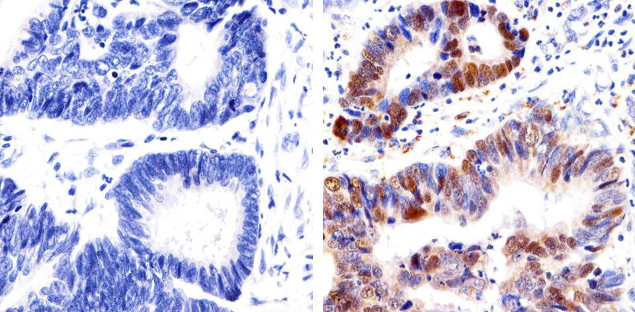 p53 Antibody in Immunohistochemistry (Paraffin) (IHC (P))