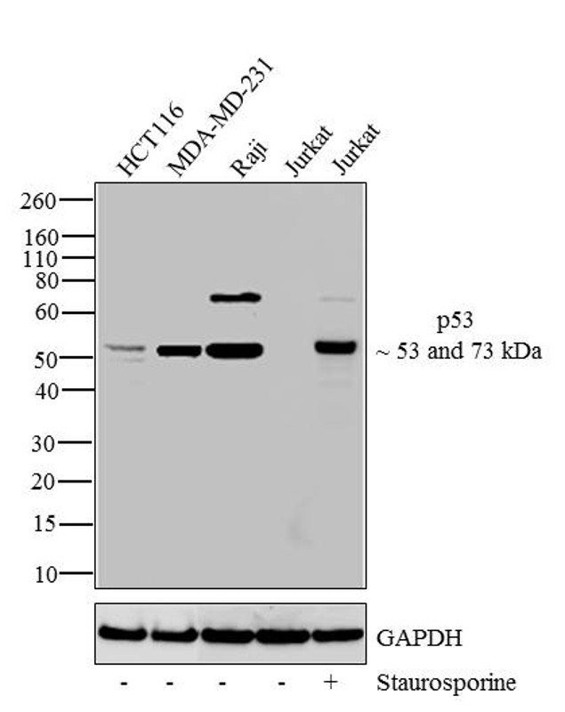 p53 Antibody in Western Blot (WB)