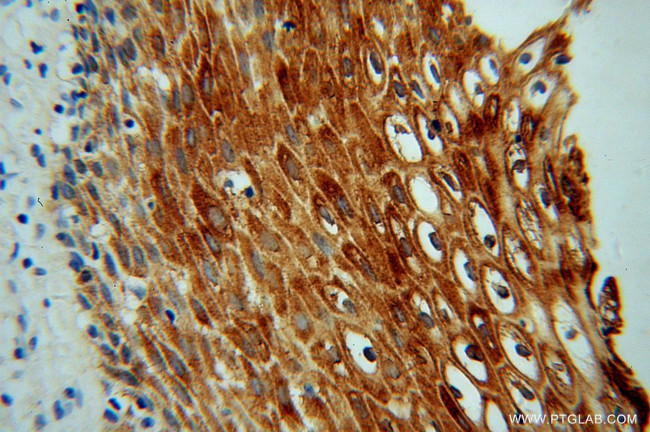 KIF22 Antibody in Immunohistochemistry (Paraffin) (IHC (P))