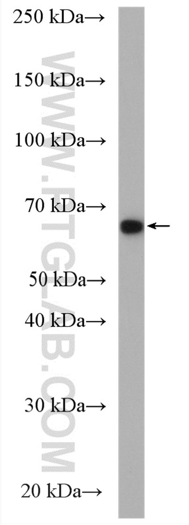 KIF22 Antibody in Western Blot (WB)