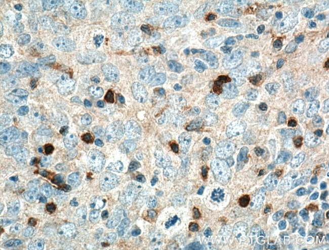 KIF22 Antibody in Immunohistochemistry (Paraffin) (IHC (P))