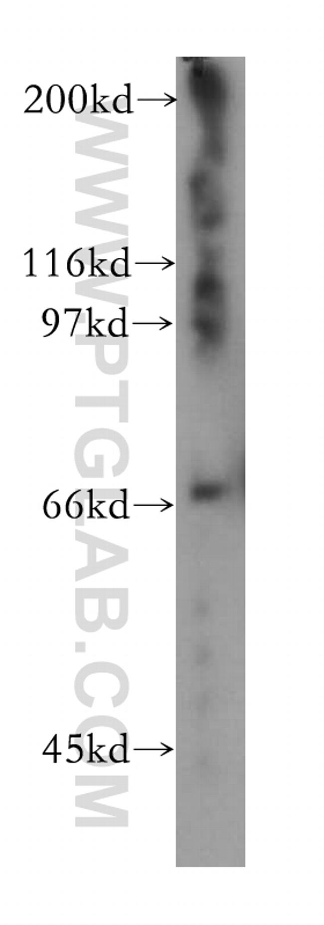 KIF22 Antibody in Western Blot (WB)