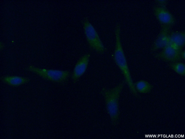 TRIM38 Antibody in Immunocytochemistry (ICC/IF)