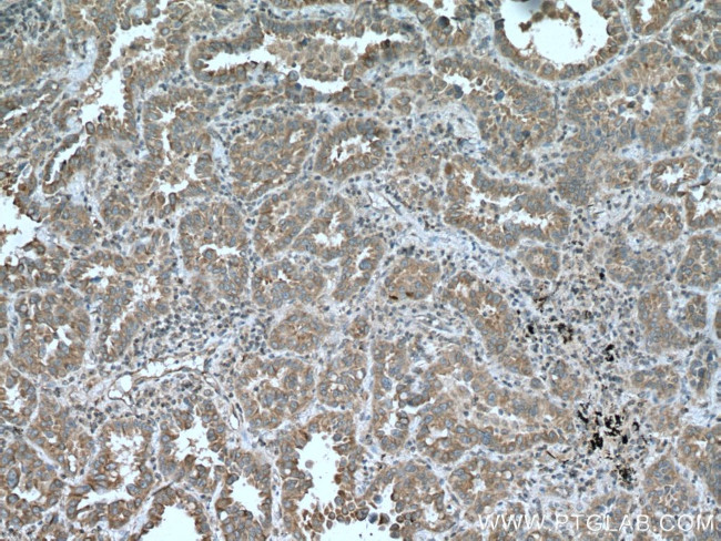 TRIM38 Antibody in Immunohistochemistry (Paraffin) (IHC (P))